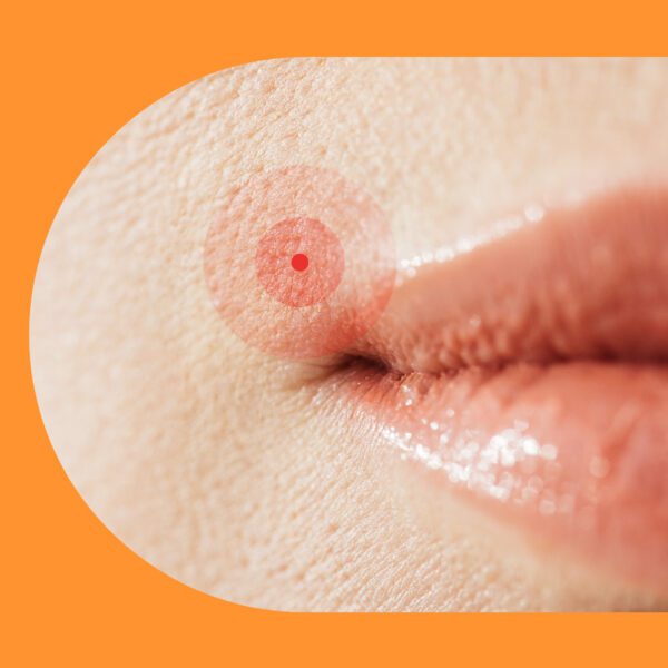 a dot marking on the face